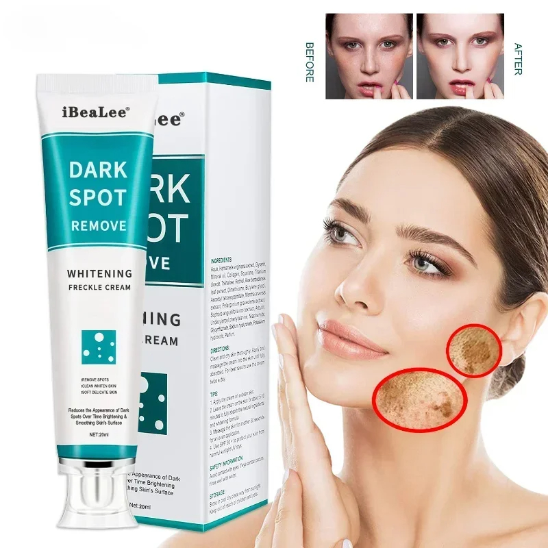 Skincare Glowing - 화이트닝 주근깨 크림 다크 스팟 제거