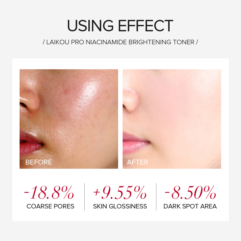 라이코우 프로 나이아신아마이드 4종 브라이트닝 스킨케어 - Niacinamide Brightening Serum 리뷰 및 가격
