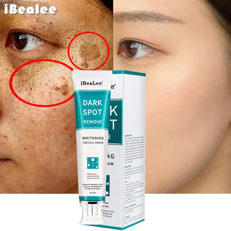 화이트닝 주근깨 크림 다크 스팟 제거 멜라스마 제거 안 - Skincare Glowing 리뷰 및 가격