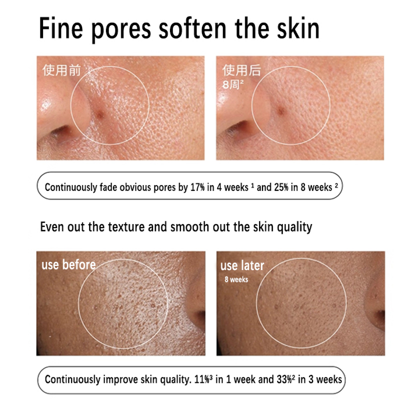 알로에 2% + NAG 2% 솔루션 세럼 30ml 멀티 - Aha Bha Exfoliant 리뷰 및 가격