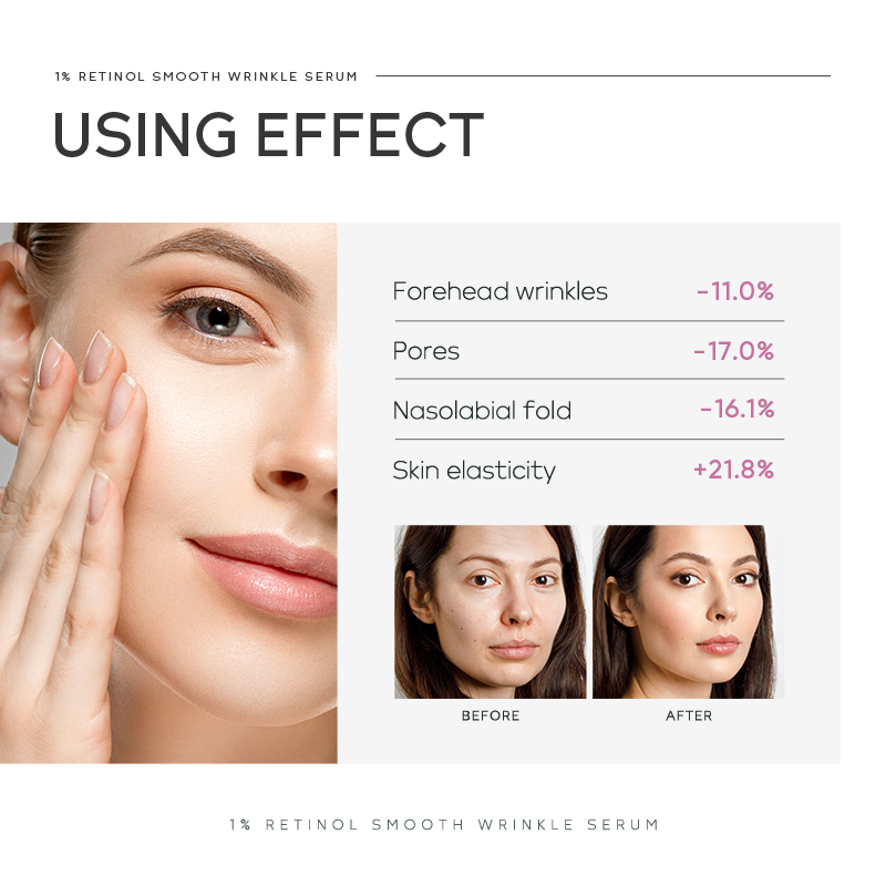 퀴윰 1% 레티놀 스무스 링클 세럼 17ml, 레티놀, - Niacinamide Brightening Serum 리뷰 및 가격
