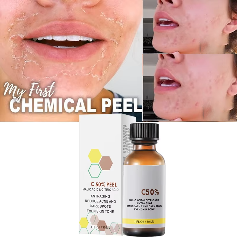 사과산과 구연산 함유 40% 필링 세럼, 화학 필링,  - Salicylic Acid Cleanser 리뷰 및 가격